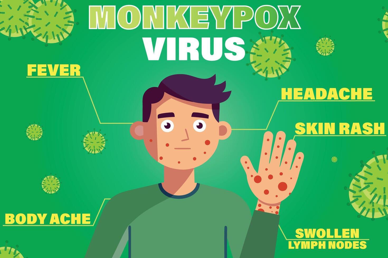 Monkeypox virus symptoms infoographic vector