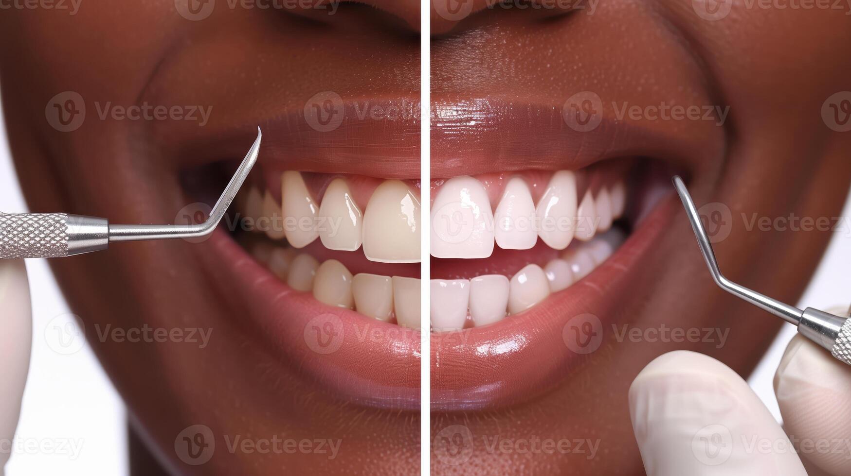 Smiling Person with Radiant White Teeth at Dental Checkup Featuring Before and After Results photo