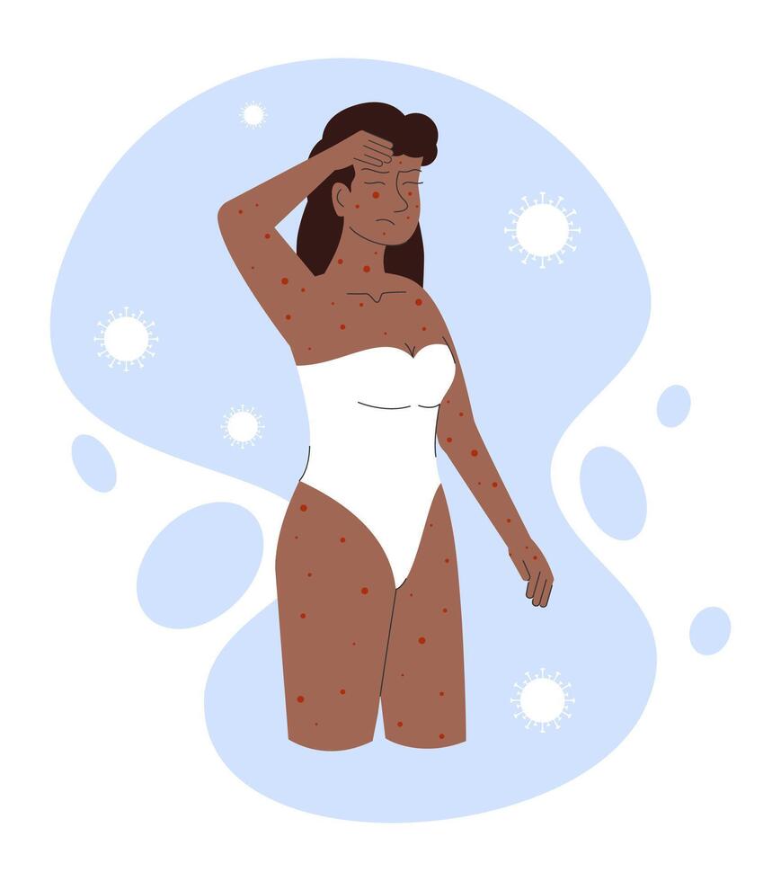 Woman suffering with rashes on all body, mpox virus. Monkeypox virus concept. New orthopox virus vector