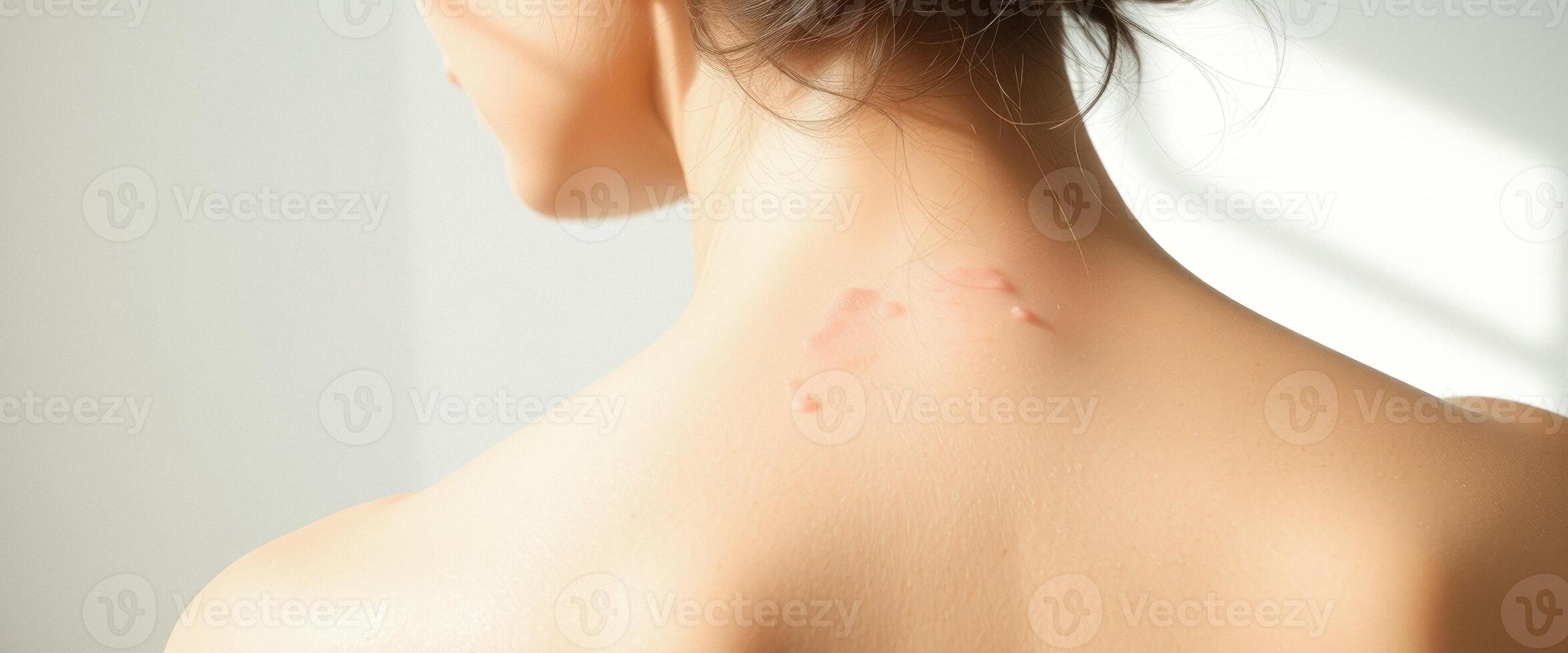 Close Up of Woman's Back with Stretch Marks photo