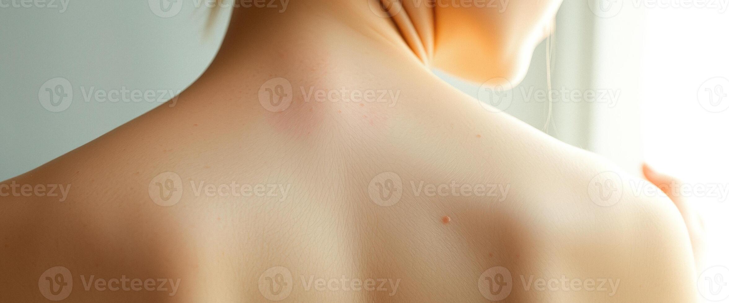 Close-up of a woman's back, soft and smooth skin with freckles, glowing in natural light. photo