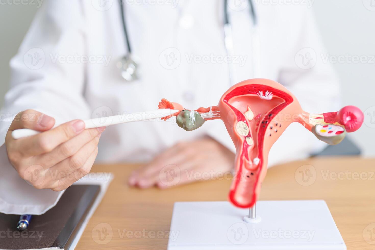 Doctor with Uterus and Ovaries anatomy model. Ovarian and Cervical cancer, Cervix disorder, Endometriosis, Hysterectomy, Uterine fibroids, Reproductive system, Pregnancy and health concept photo