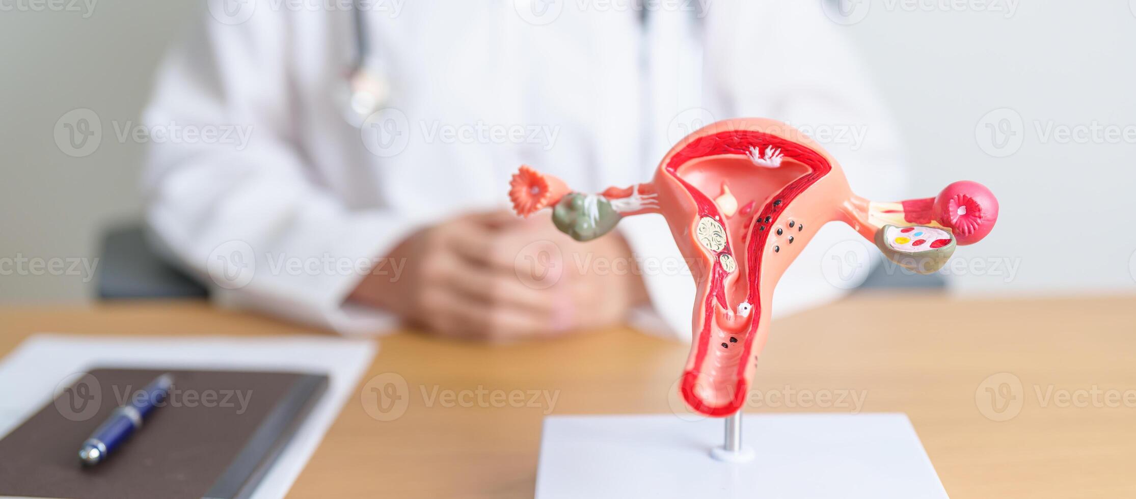 Doctor with Uterus and Ovaries anatomy model. Ovarian and Cervical cancer, Cervix disorder, Endometriosis, Hysterectomy, Uterine fibroids, Reproductive system, Pregnancy and health concept photo