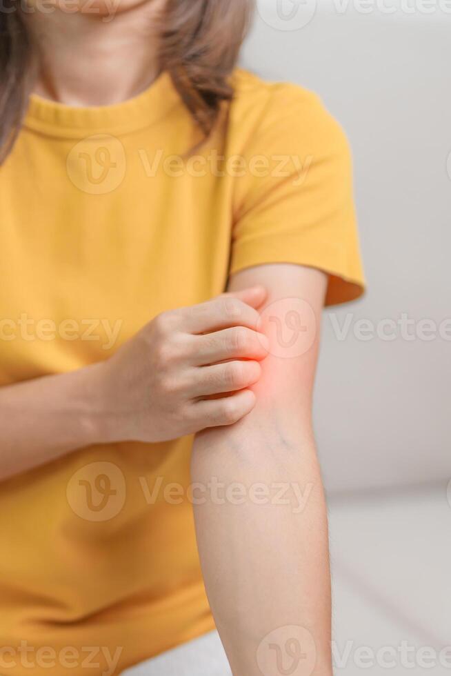 woman itching and scratching itchy arm. Sensitive Skin Allergic reaction to insect bite, food, drug dermatitis. Dermatology, Leprosy day, Systemic lupus erythematosus, Allergy symptoms and rash Eczema photo