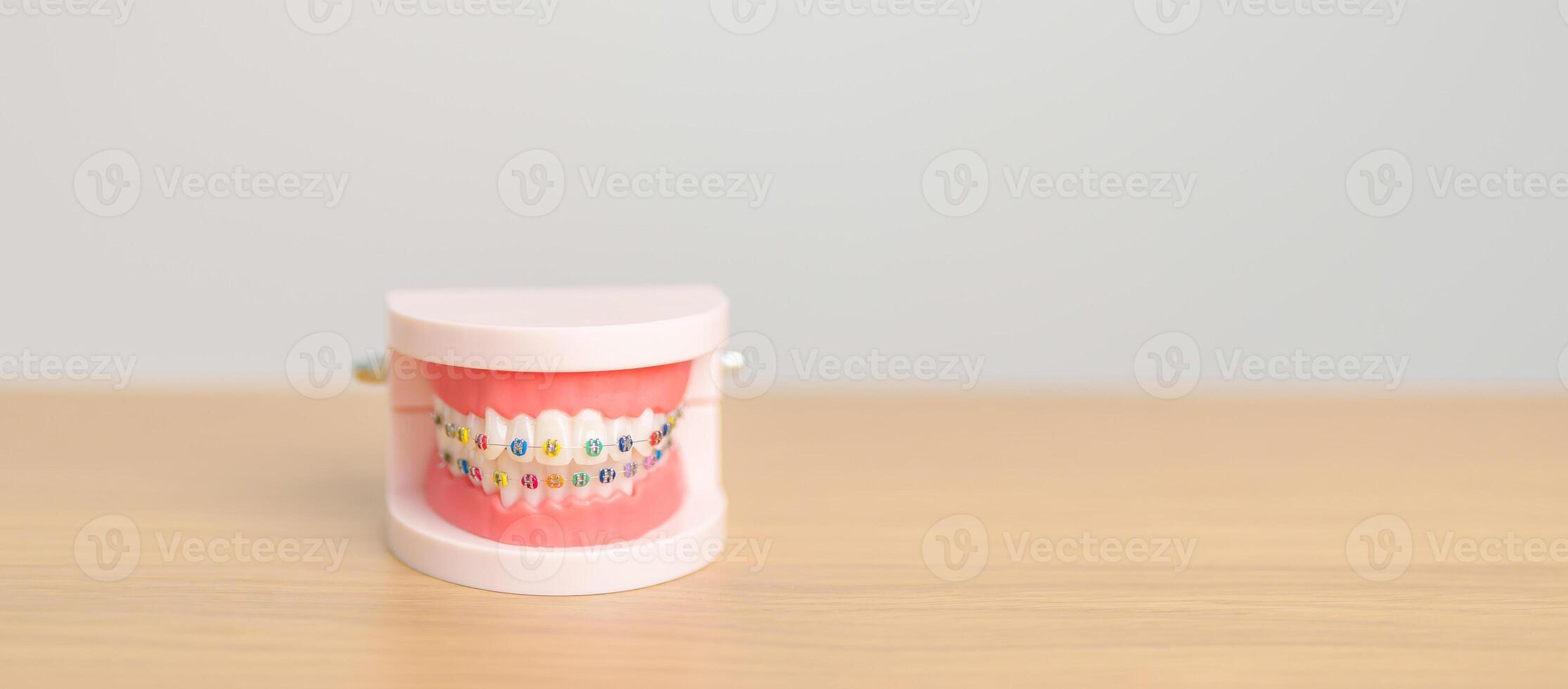 Orthodontic tooth model and bracket or brace. Clean and Scrape off tartar. May Orthodontic Health Day, March Oral health, Dentist Day, False Teeth. Toothache and Children Dental Health photo