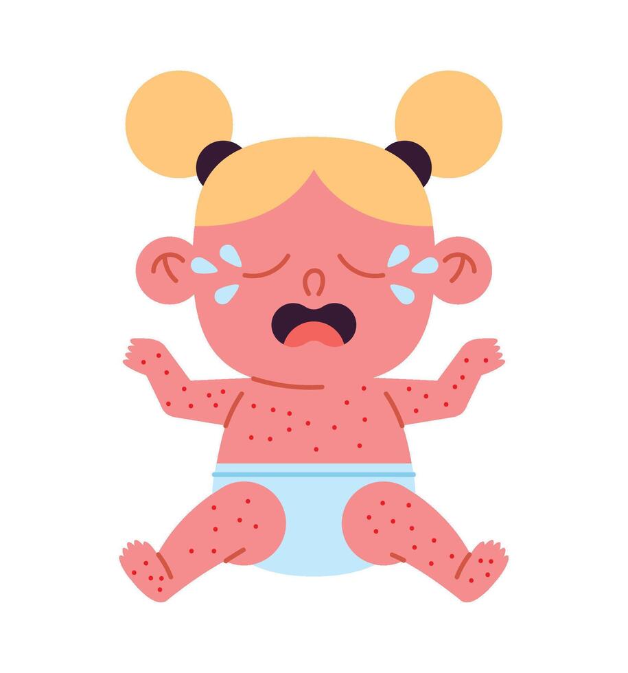 A cartoon baby crying with a rash on its face vector