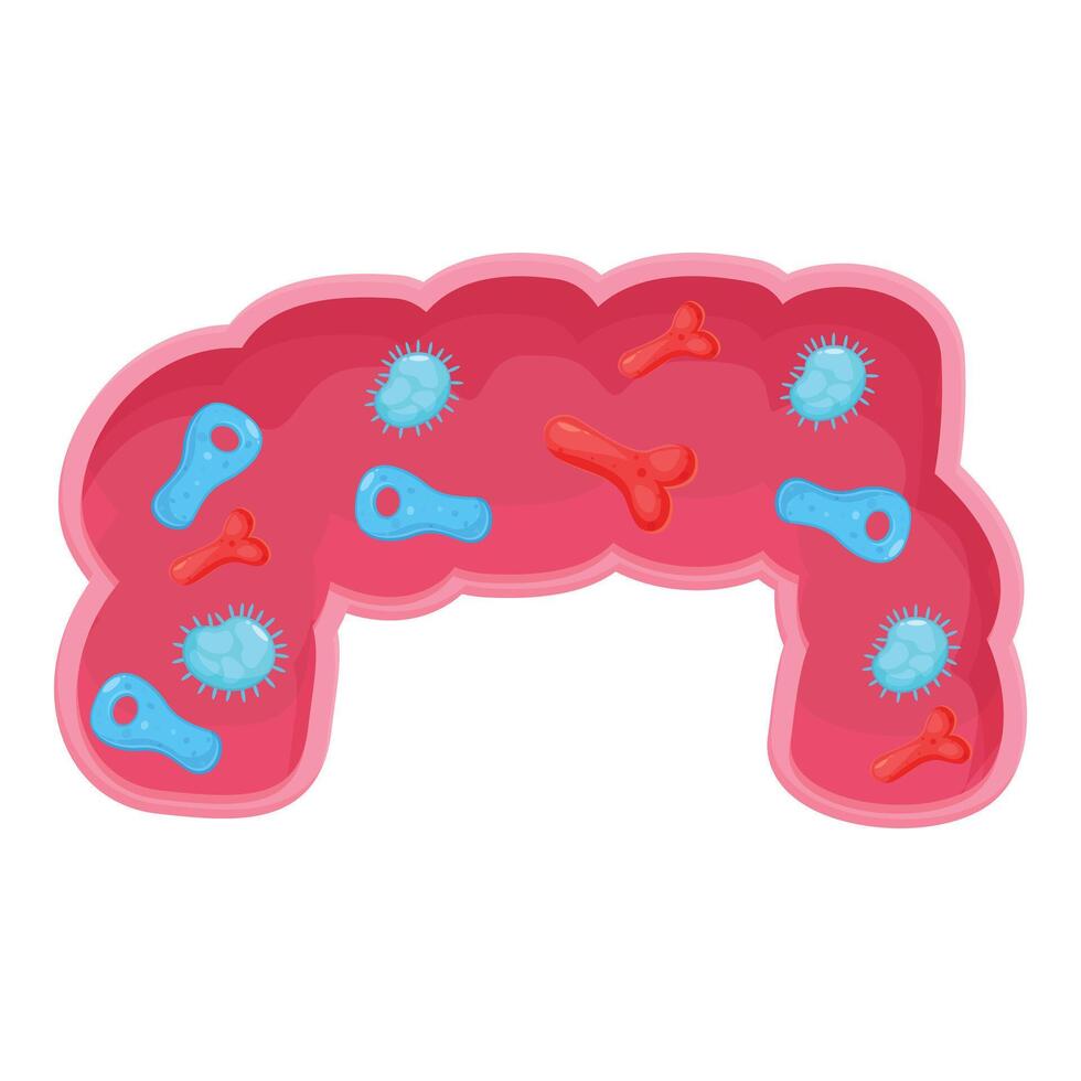 Bacteria and viruses living in human intestine causing inflammation vector