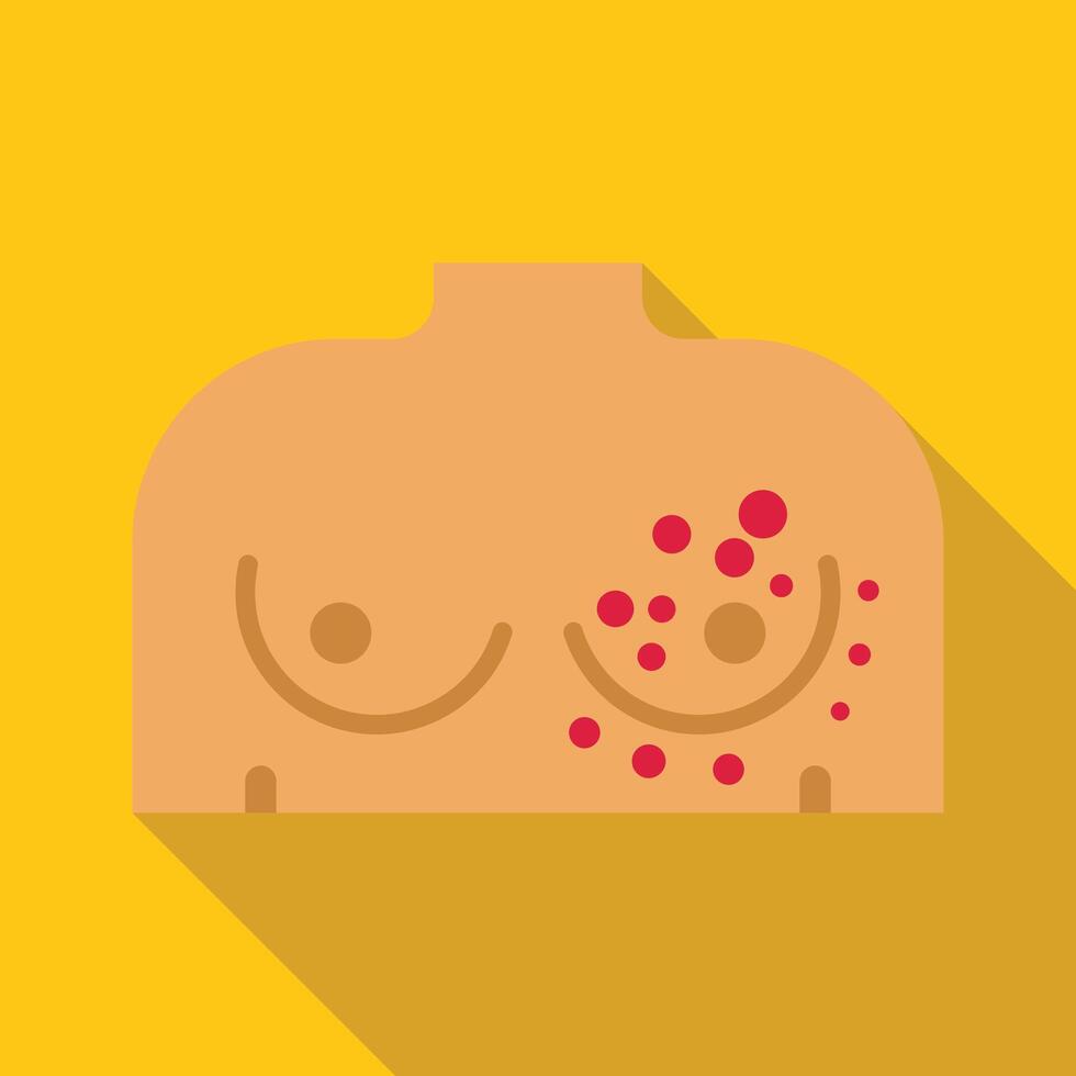 Female chest showing symptoms of chickenpox virus vector