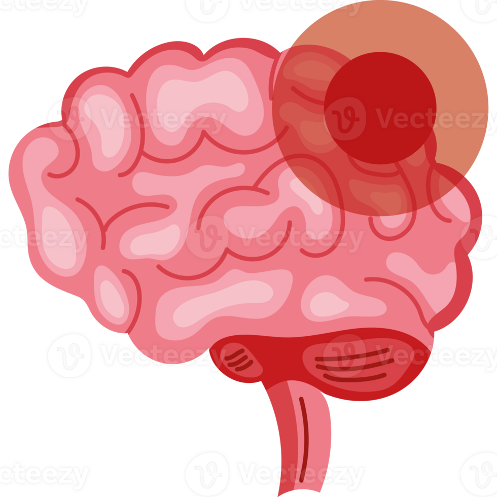 Brain cancer brain cancer brain cancer brain cancer brain cancer brain cancer brain cancer brain cancer brain cancer brain png