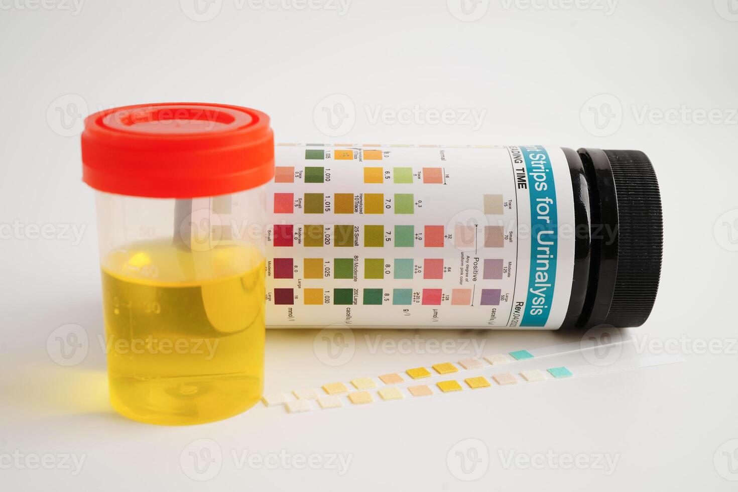 Urinalysis, urine cup with reagent strip pH paper test and comparison chart in laboratory. photo
