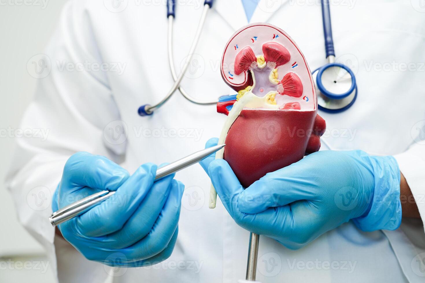 Chronic kidney disease, doctor with model for treatment urinary system, urology, Estimated glomerular filtration rate eGFR. photo