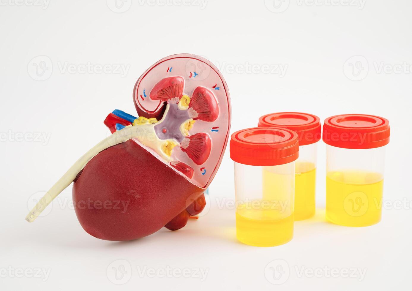 Urinalysis, Kidney and urine cup for check health examination in laboratory. photo