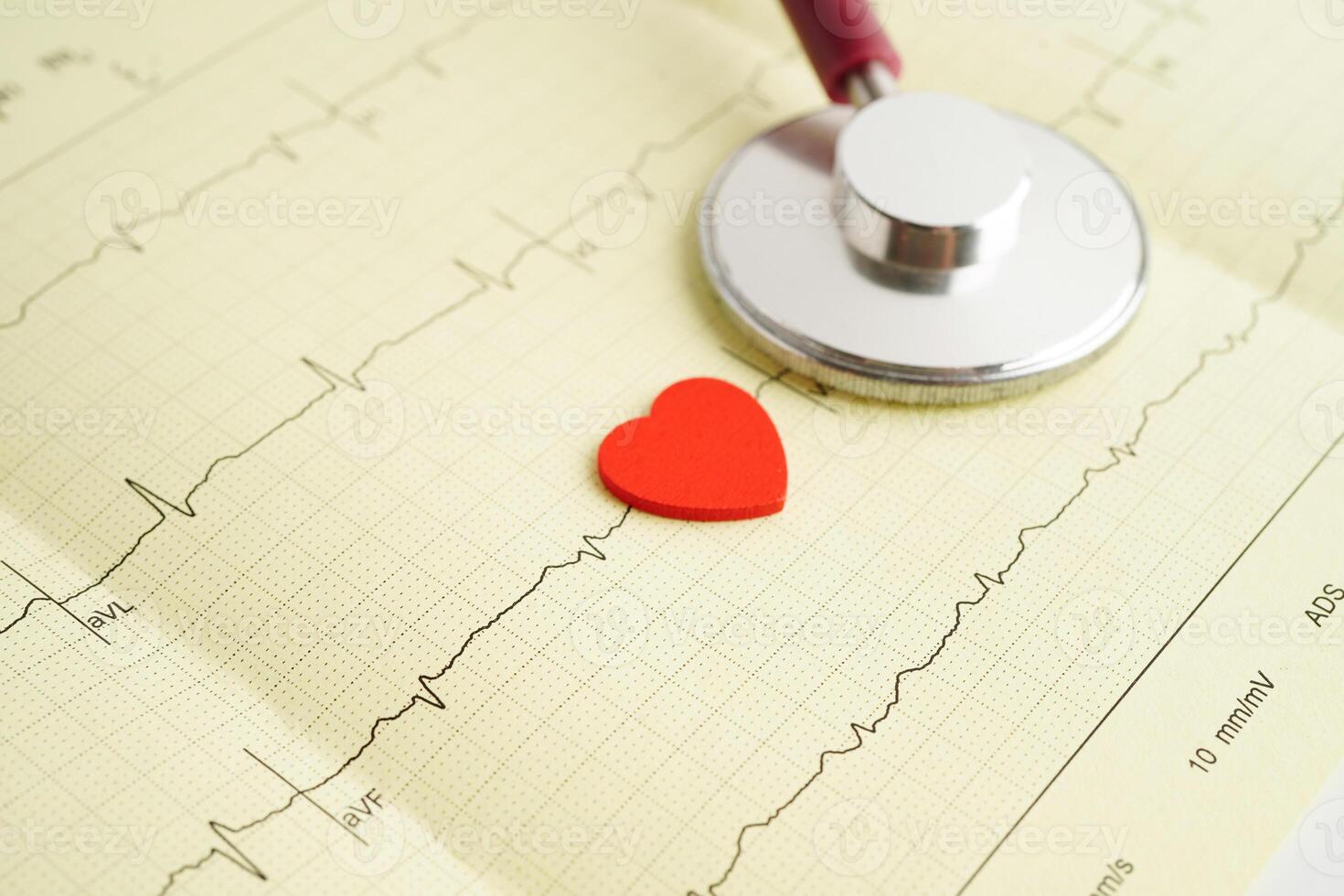 Stethoscope on electrocardiogram heart wave, heart attack, cardiogram report. photo