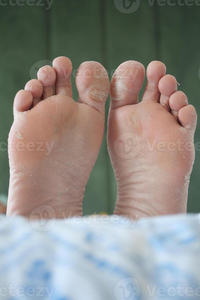 close up of young man dry feet on bed , photo