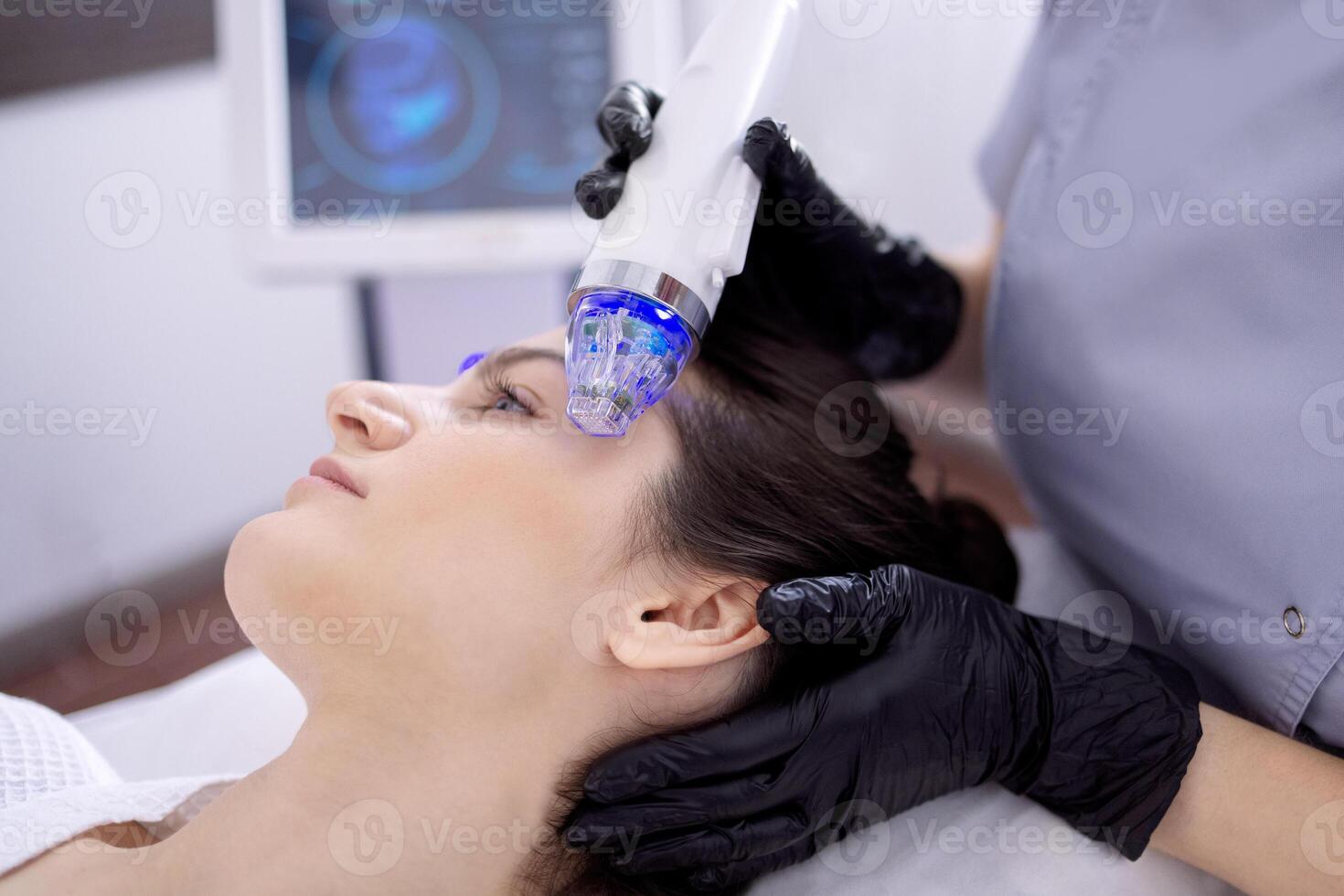 Microneedle RF lifting procedure. Hardware cosmetology. photo