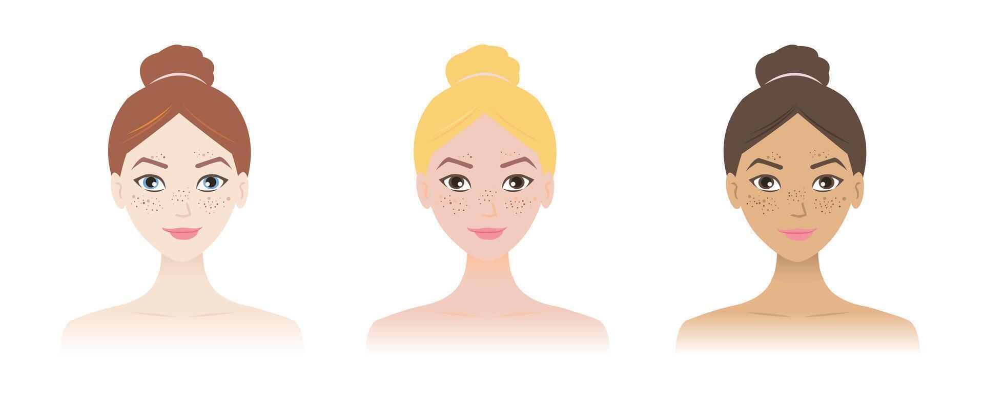 The women with freckles on different skin tone illustration isolated on white background. Ephelides can occur in anyone light skin and have blond or red hair, but anyone can have freckles. vector