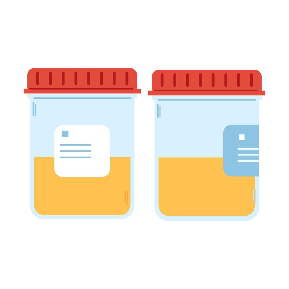 Set of two medical tubes with urine samples. Laboratory container. Pee sample in plastic containers vector