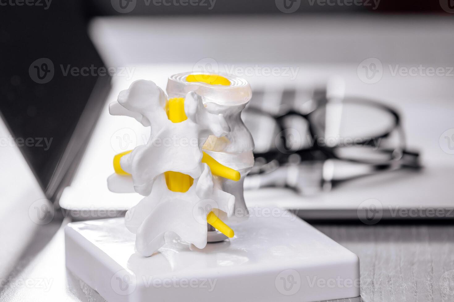 Close-up of a spine model on a physiotherapist's desk, alongside a laptop and glasses. Ideal for depicting spinal treatment procedures and orthopedic care in a modern medical environment photo