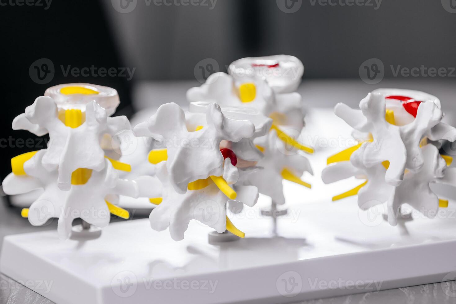 In a modern medical office, a doctor analyzes a spine X-ray alongside anatomical models, documenting findings on a laptop. Perfect for illustrating advanced diagnostics and patient care photo