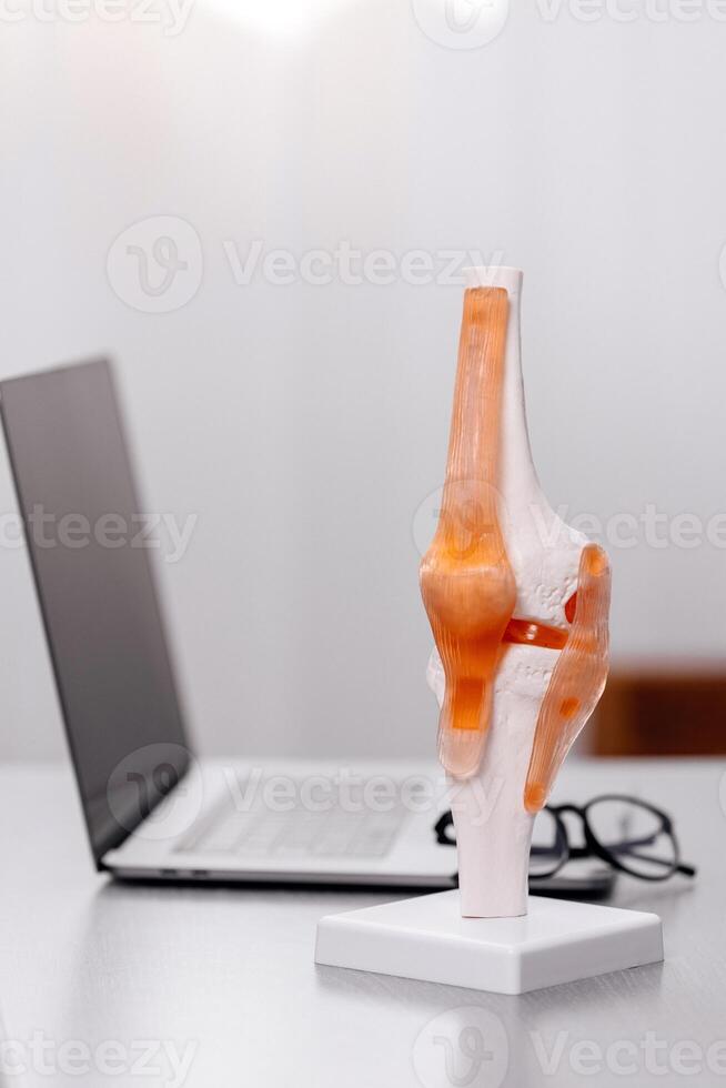 Close-up of a knee model showing osteoarthritis and knee arthroplasty. A doctor explains the symptoms and treatment options to a patient, emphasizing advanced medical care and patient education photo