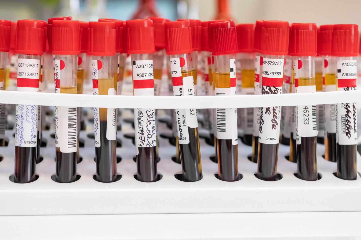 Blood tubes test for analysis photo