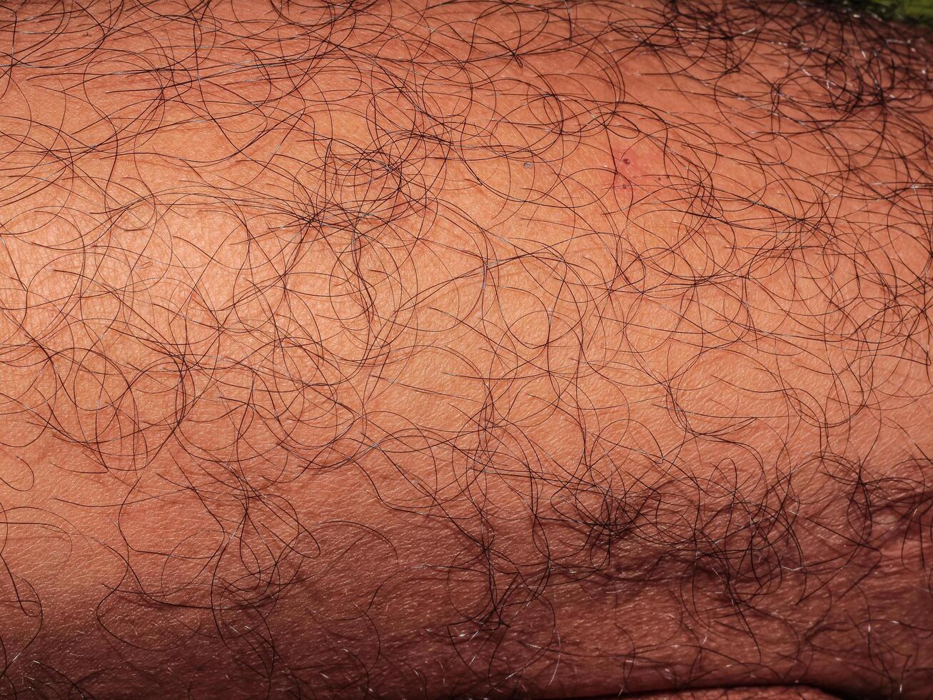 Hair on human skin, shin of hairy man's leg photo