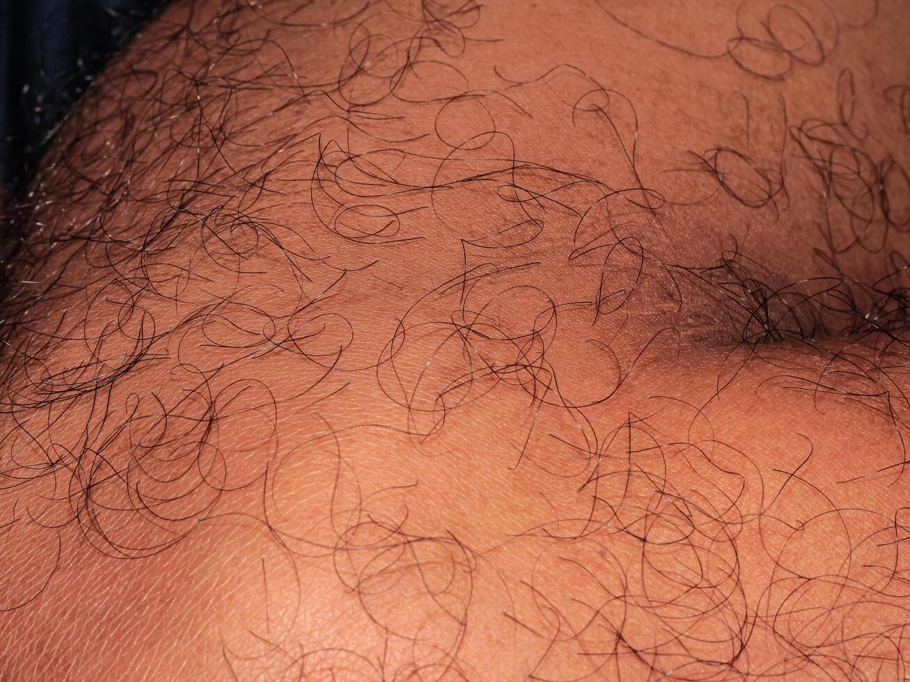 pelo en humano piel, espinilla de peludo del hombre pierna foto