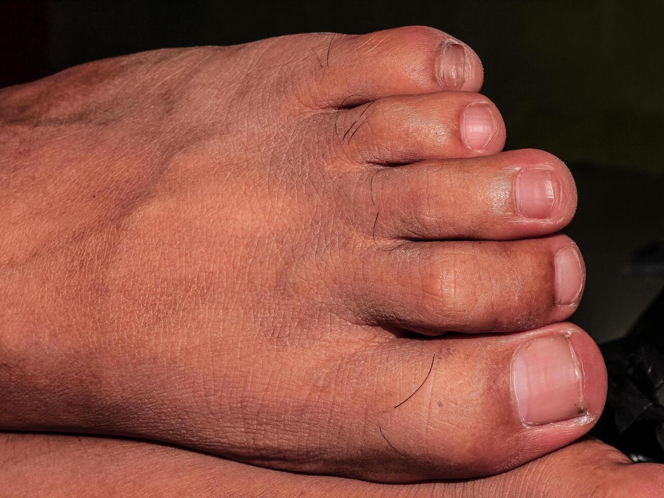Male feet with clean white nails with brown skin color photo