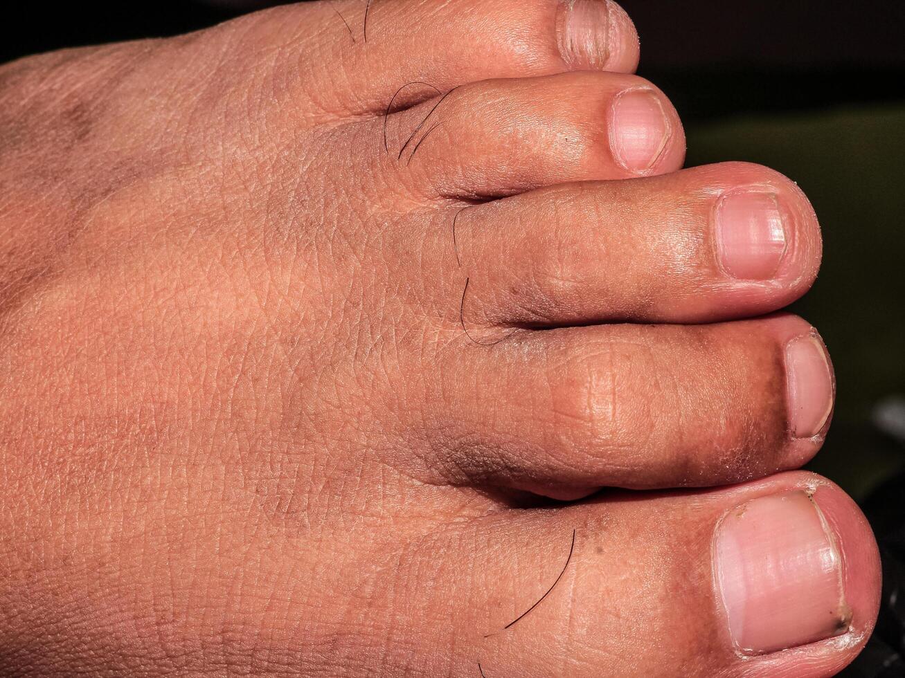 Male feet with clean white nails with brown skin color photo