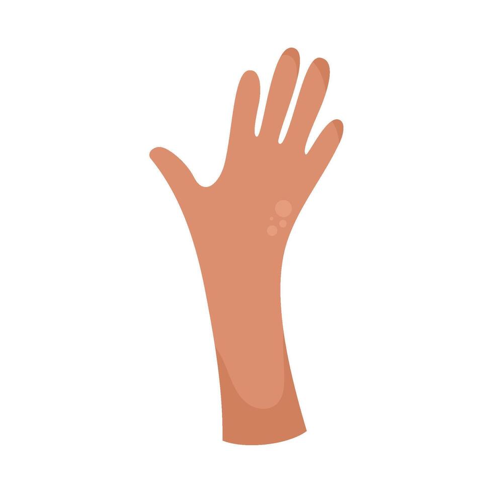 Hand with skin rash illustration vector