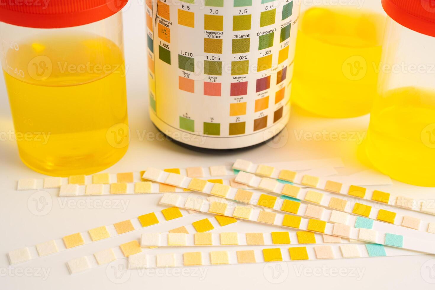 Urinalysis, urine cup with reagent strip pH paper test and comparison chart in laboratory. photo