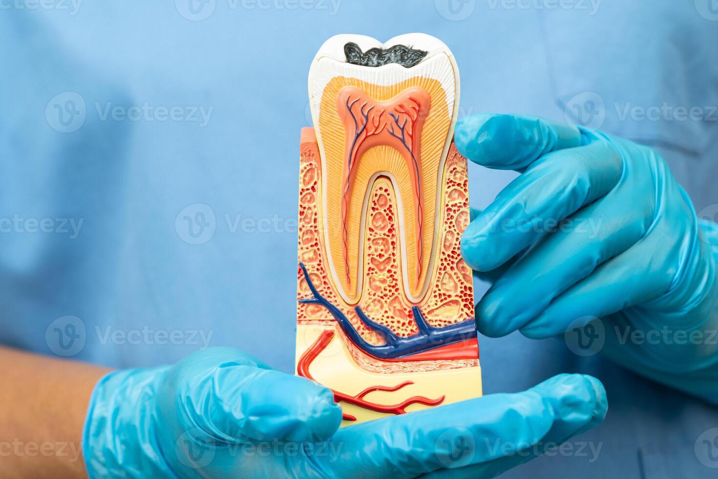 Asian dentist holding dental implant, artificial tooth roots into jaw, root canal of dental treatment, gum disease, teeth model for dentist. photo