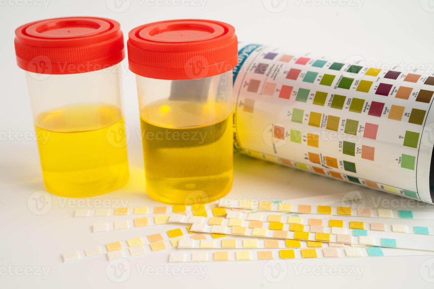 Urinalysis, urine cup with reagent strip pH paper test and comparison chart in laboratory. photo