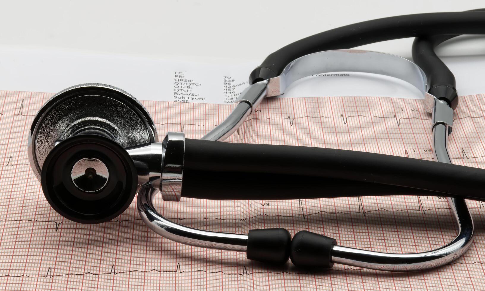 Stethoscope on electrocardiogram in paper form. Heart prevention. photo
