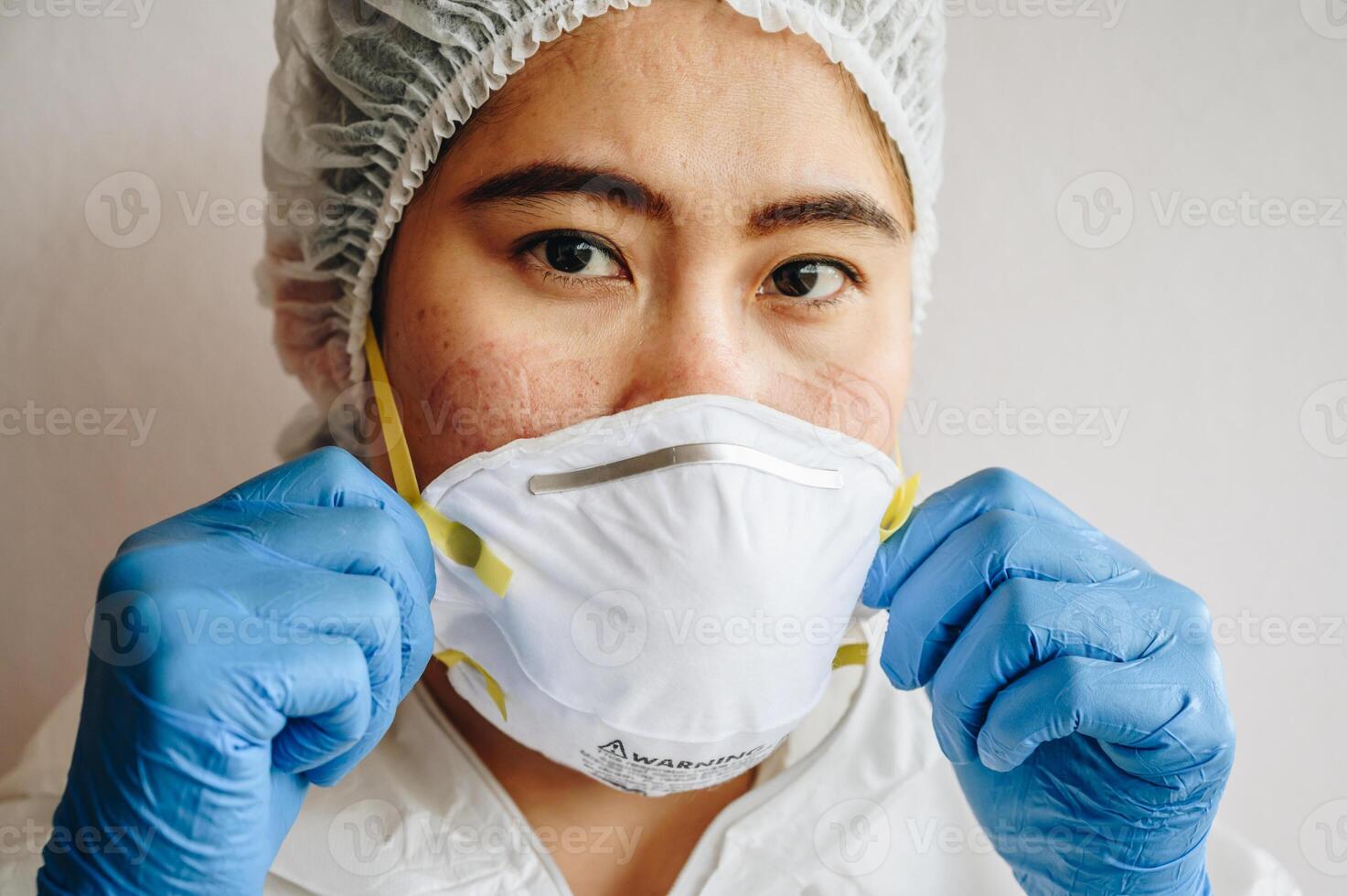 Healthcare worker with acne and facial wounds occur from a medical mask after work for a long time in hospital during covid-19 pandemic. Wearing mask for prolonged periods can damage the skin. photo