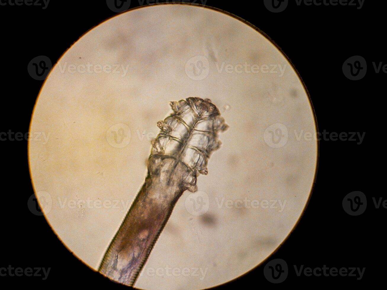 Demodex folliculorum - parasitic mite on the eyelashes of a human eye photo