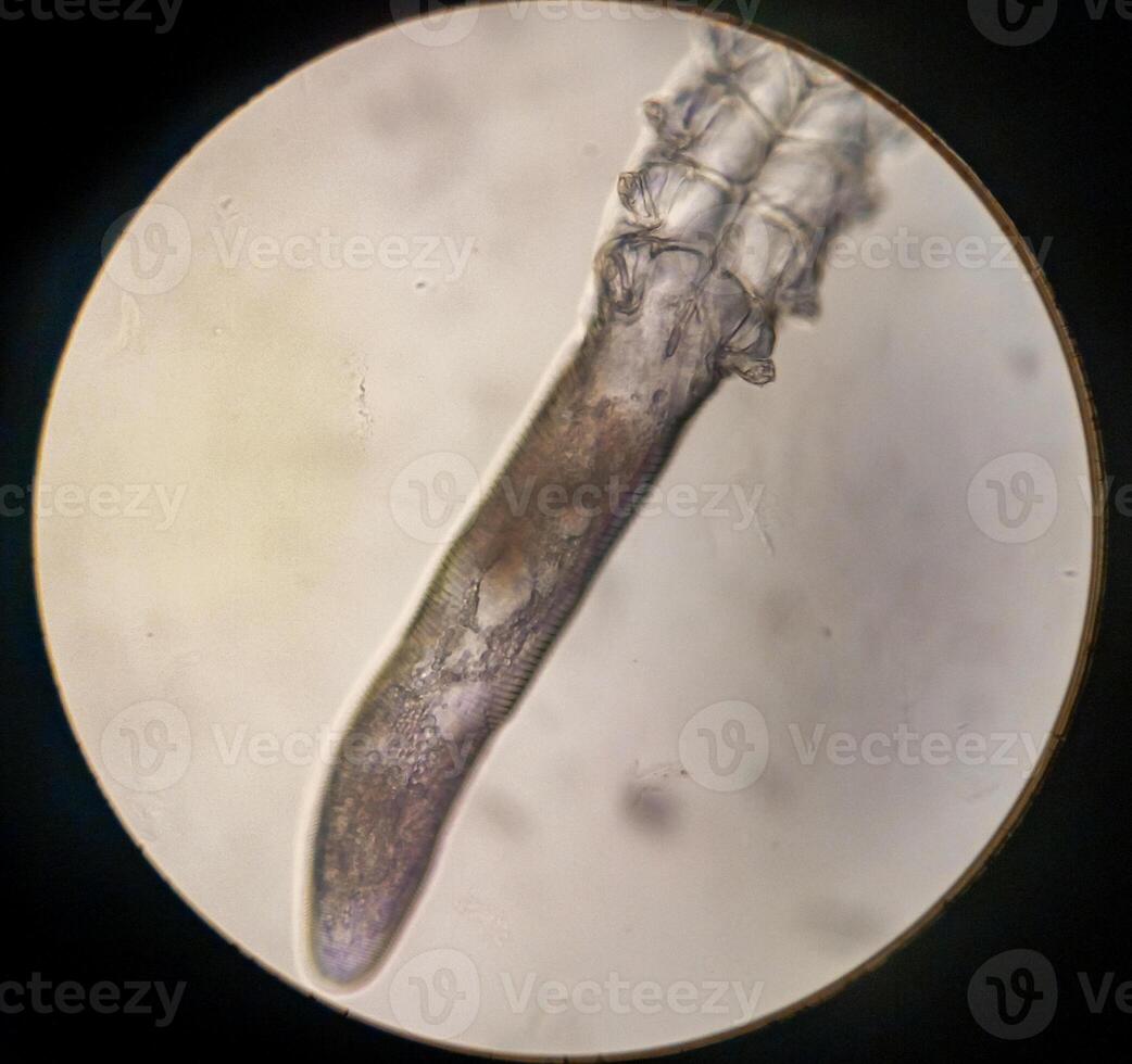Demodex folliculorum - parasitic mite on the eyelashes of a human eye photo