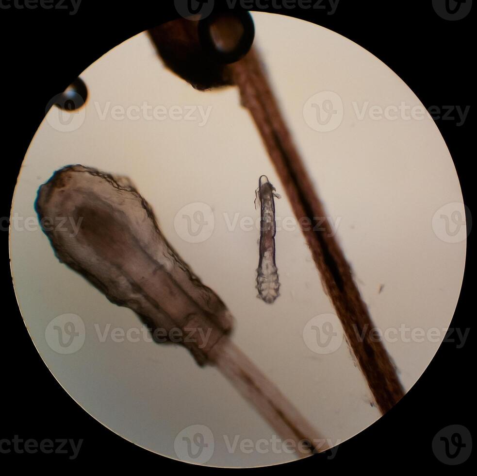 Demodex folliculorum - parasitic mite on the eyelashes of a human eye photo