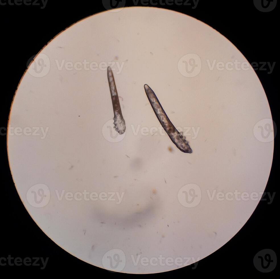 Demodex folliculorum - parasitic mite on the eyelashes of a human eye photo