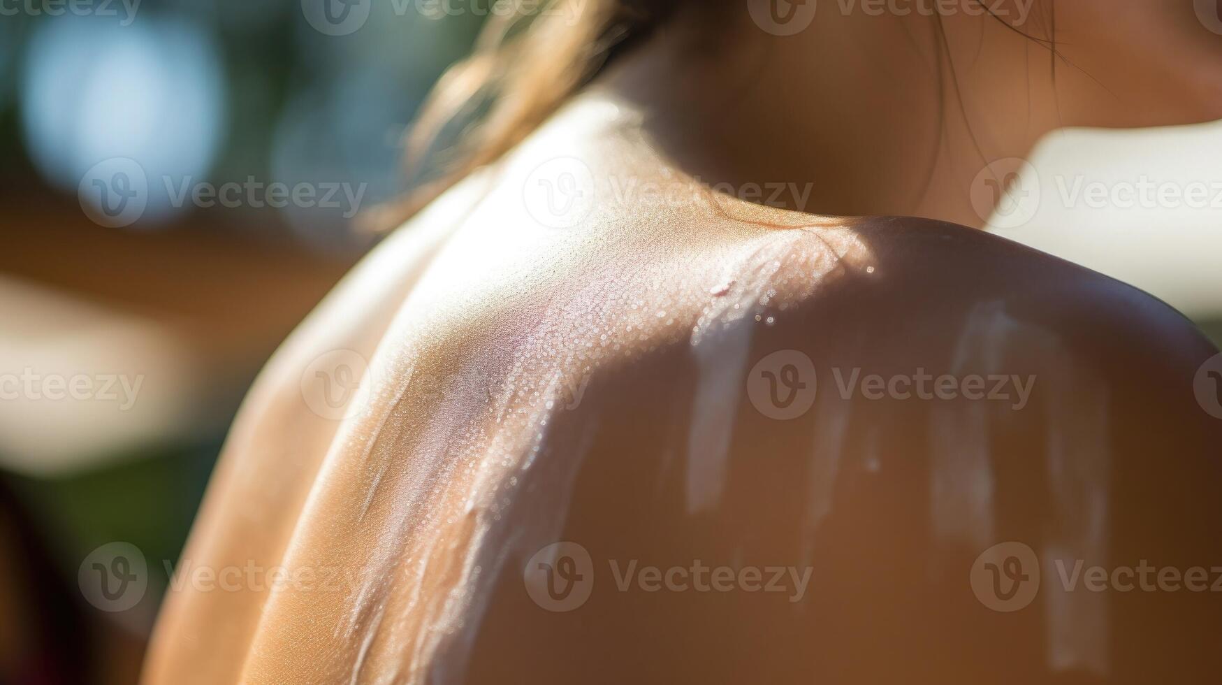 Closeup of a sunburned shoulder being carefully coated in a thick layer of sunscreen. photo