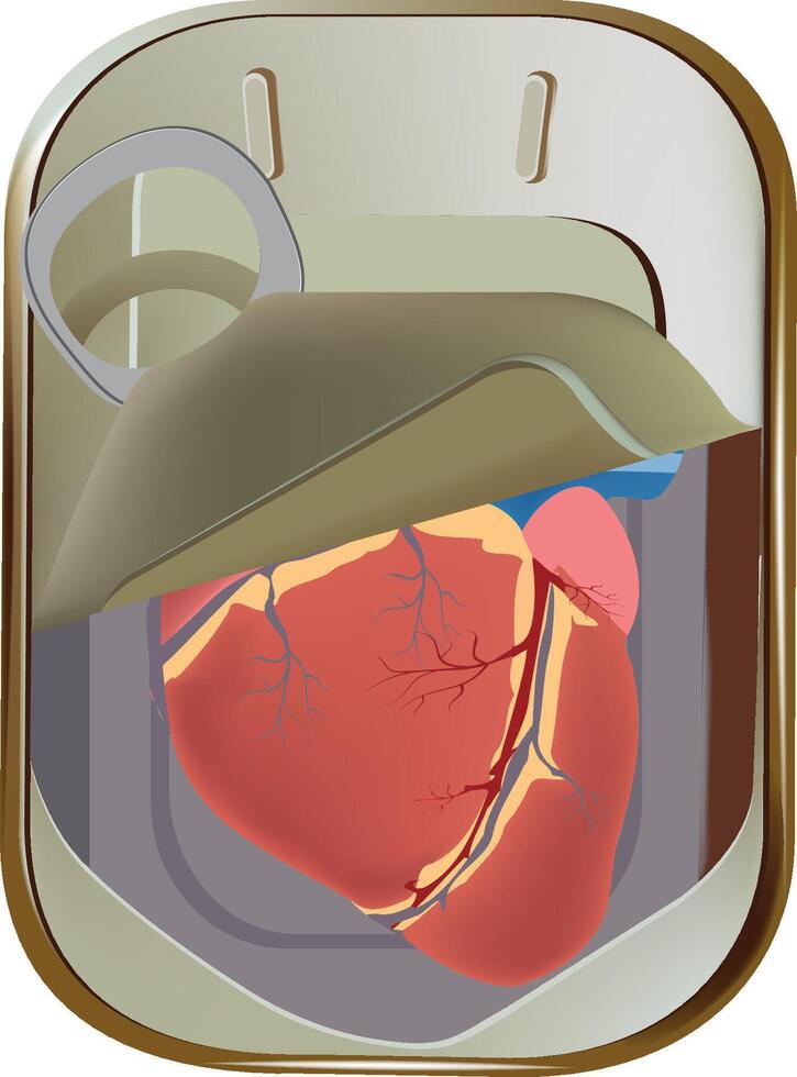 Human heart is preserved in a tin can illustrating organ donation concept vector