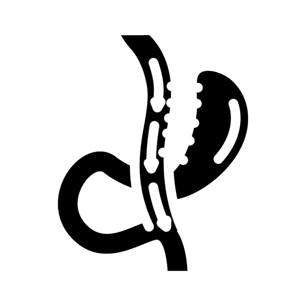 anastomosis surgery glyph icon illustration vector