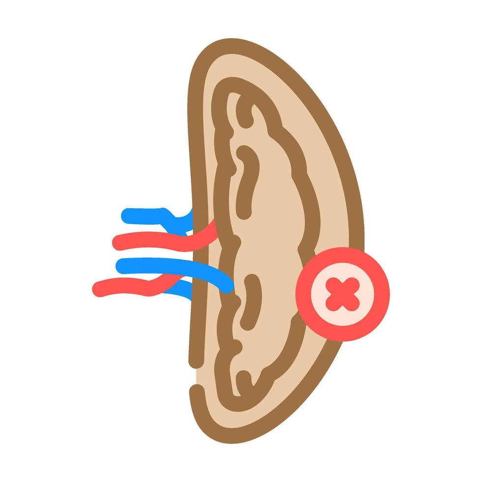 splenectomy surgery color icon illustration vector
