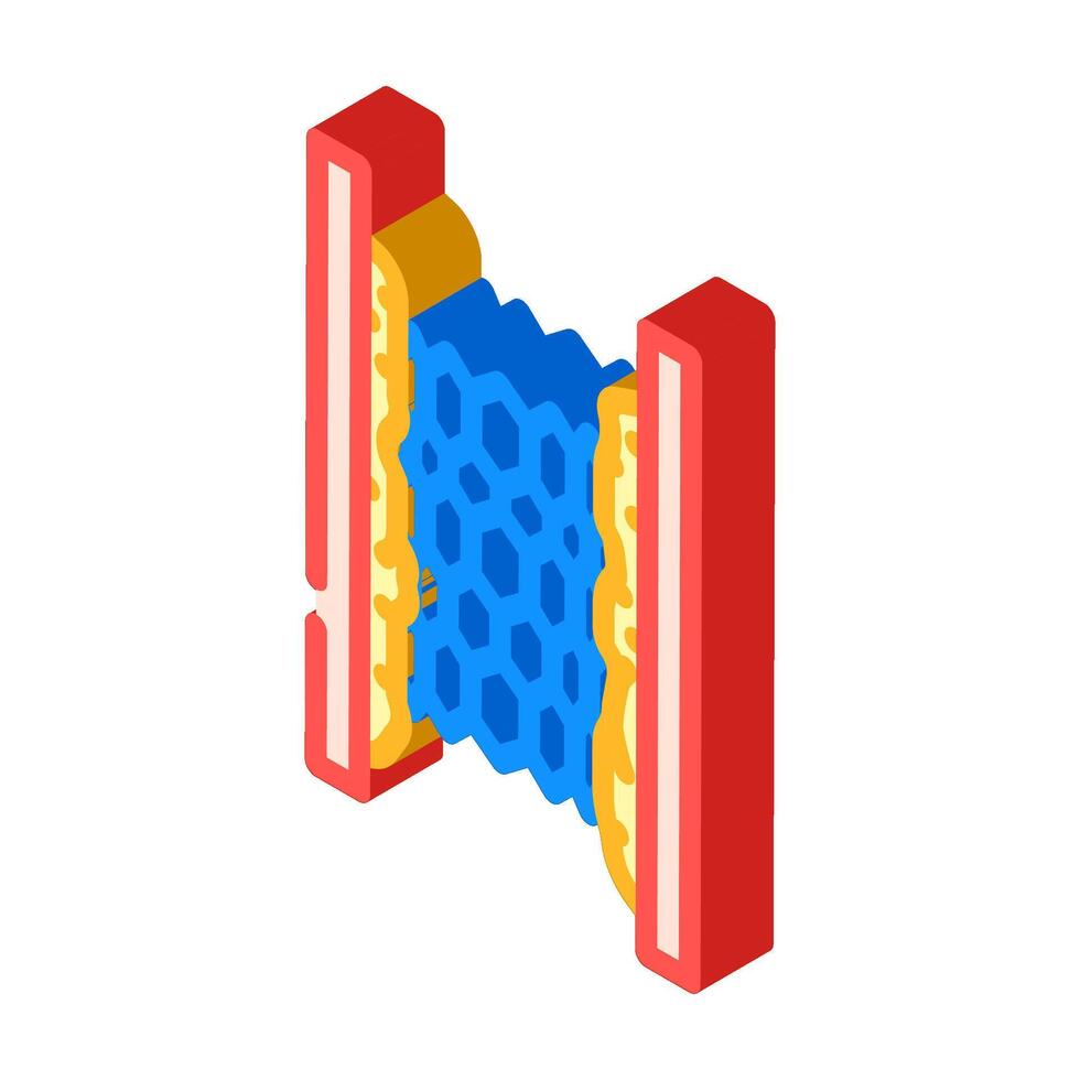 stent placement surgery isometric icon illustration vector