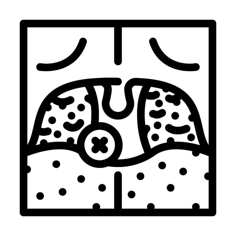tonsillectomy surgery line icon illustration vector
