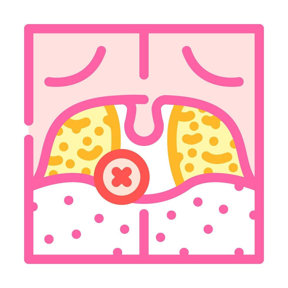tonsillectomy surgery color icon illustration vector