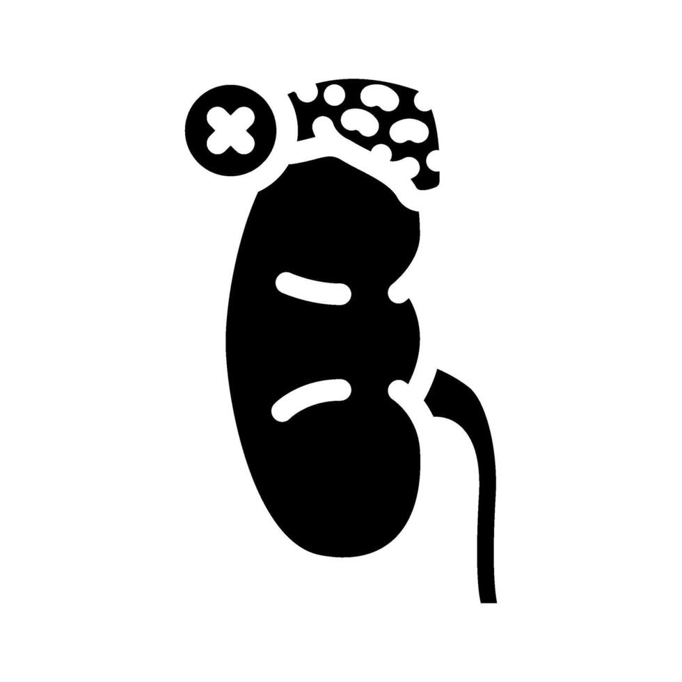 adrenalectomy surgery glyph icon illustration vector