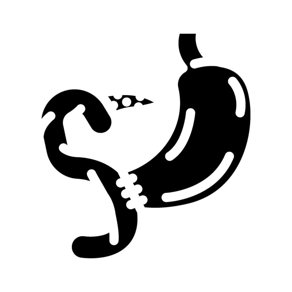 whipple procedure surgery glyph icon illustration vector