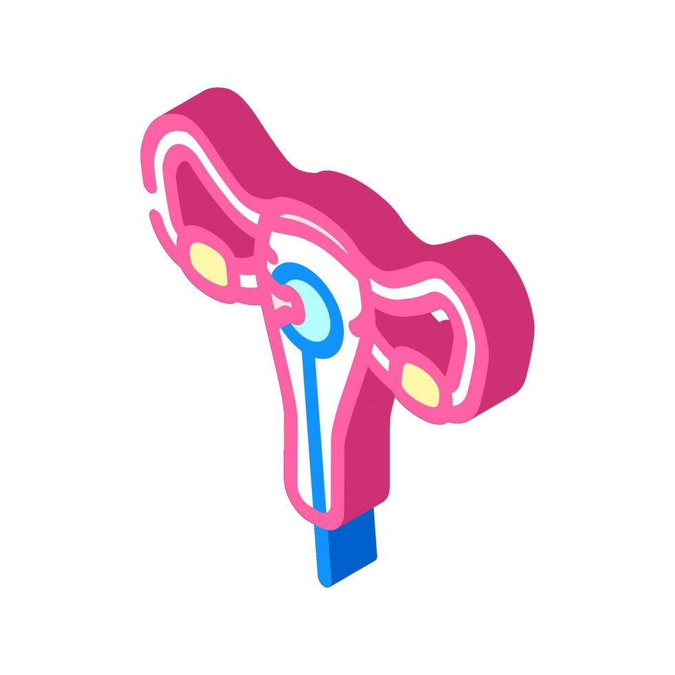 dilation and curettage surgery isometric icon illustration vector