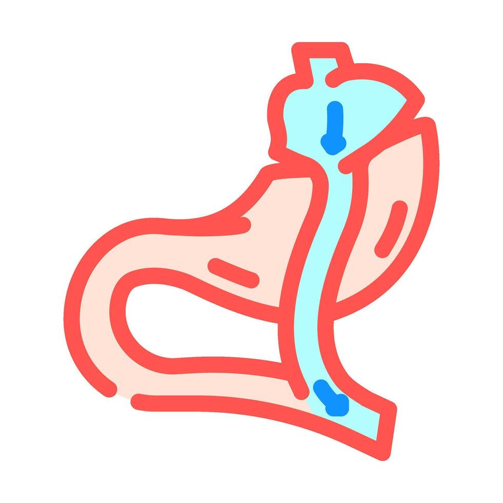 gastric bypass surgery color icon illustration vector